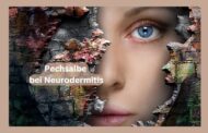 Pechsalbe bei Neurodermitis: Die Wirkung von Pechsalbe bei Neurodermitis