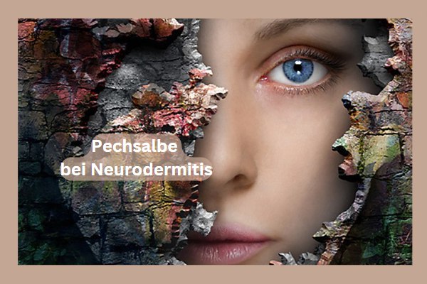 Pechsalbe bei Neurodermitis: Die Wirkung von Pechsalbe bei Neurodermitis